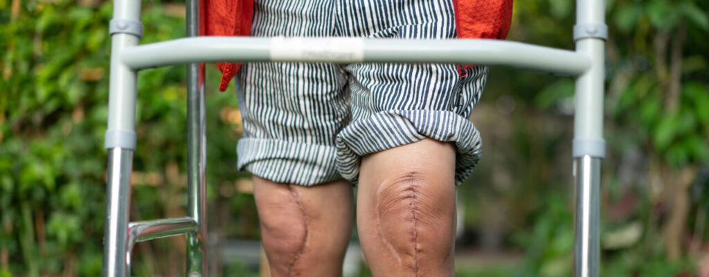 post-operative exercises for knees